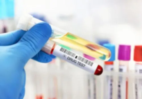 Point of Collection Testing POCT Drug Test