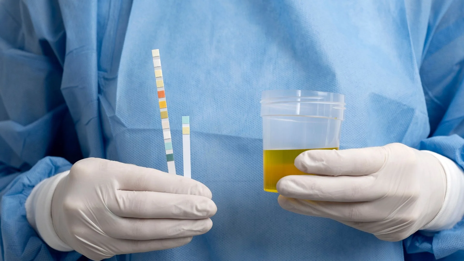 Pre-employment drug test Frequently Asked Questions