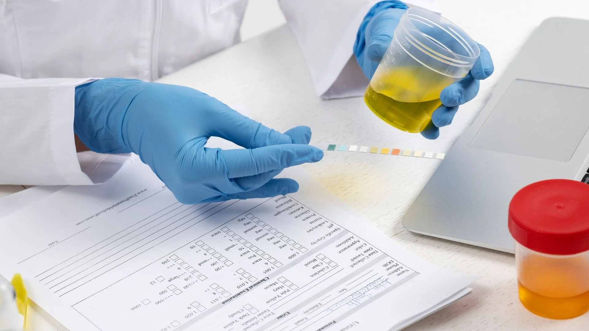10-Panel Drug Test: What It Screens For?